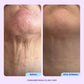 Neck Cream Tighten & Lift Firming Cream for Crepey Skin
