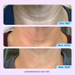 Neck Cream Tighten & Lift Firming Cream for Crepey Skin