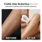 ✨IPL Ice-Cooling Hair Removal Device💎Pain-free facial and body hair removal—includes protective goggles